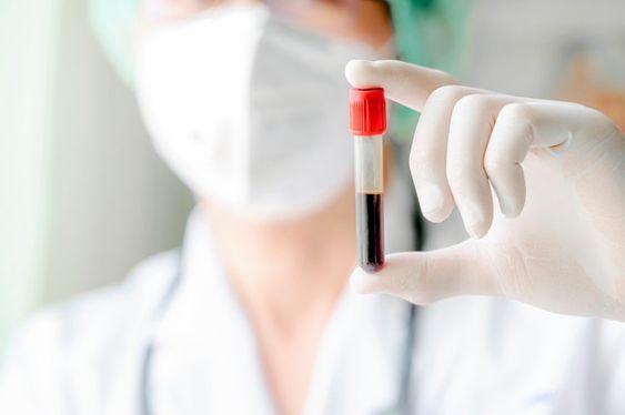 A doctor holding a medical tube that was mold using a 2k injection